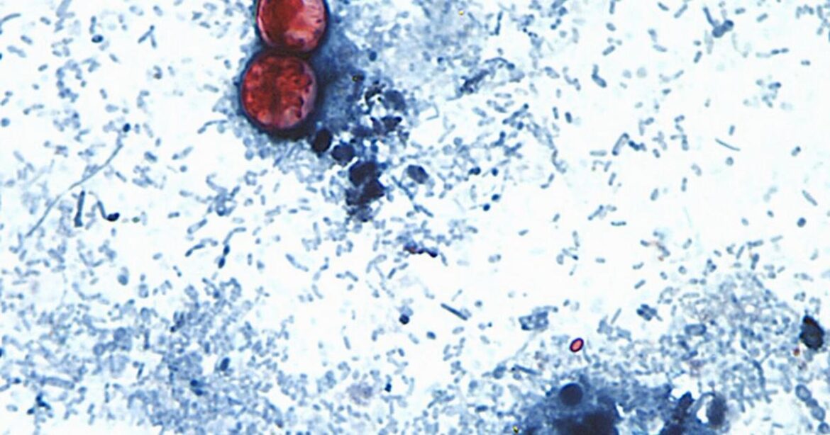 Cyclospora fears take a bite out of sales at local salad restaurant | Local News