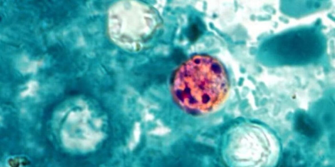 Cases of Cyclosporiasis double on average in North Dakota this summer