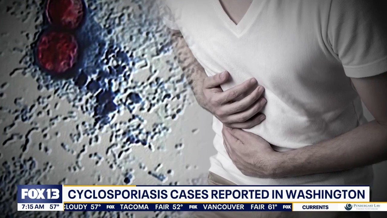 WA cyclosporiasis cases: What we know about the parasite