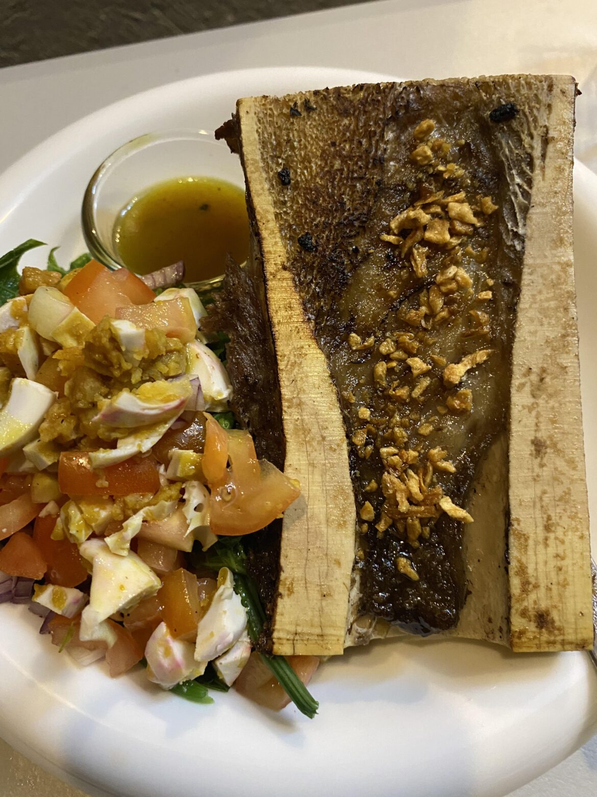 BONE MARROW SA BAGUIO CITY