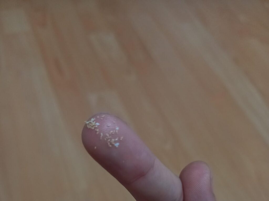 Are these bug eggs? They came out of a newly opened package of short grain rice?