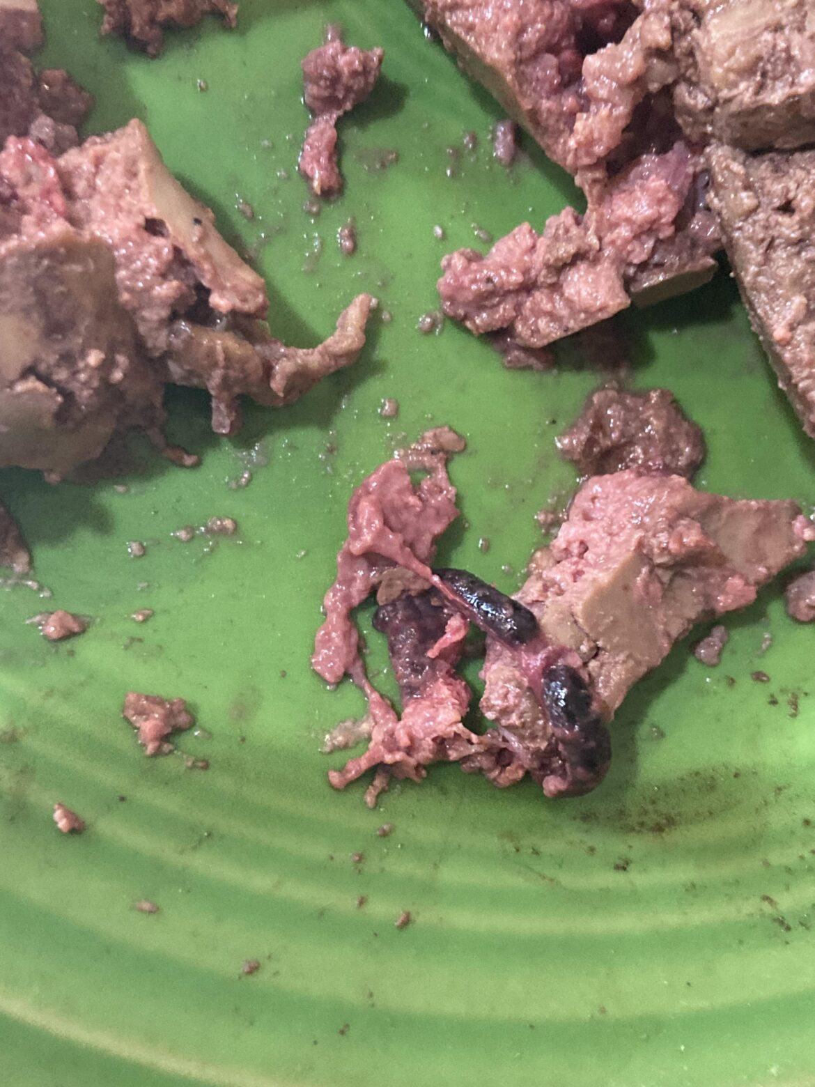 What’s this black thing in my liver? Kinda looks like a poop