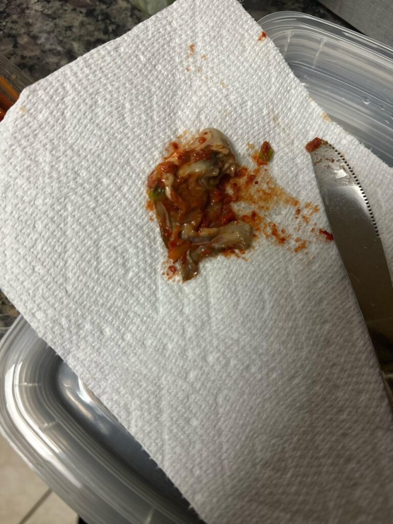 Should I be concerned?