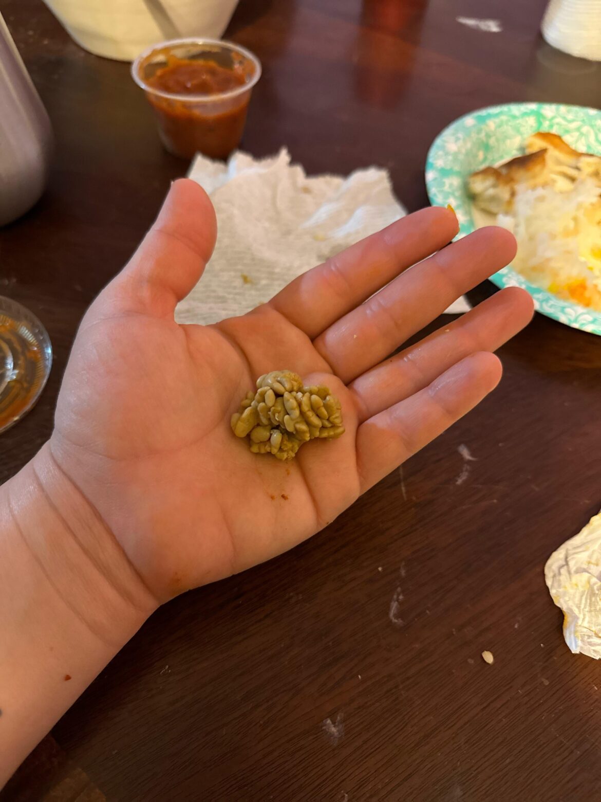 What is this brain looking food in my guk?