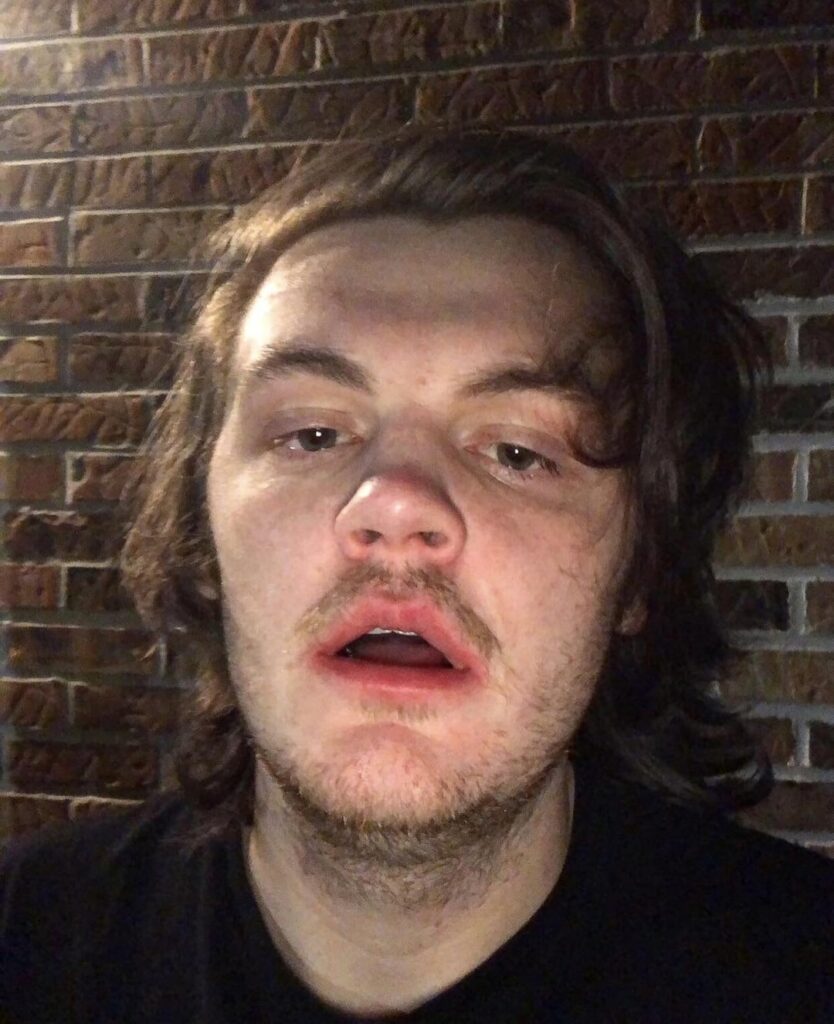 Back when I did the 2022 One Chip Challenge