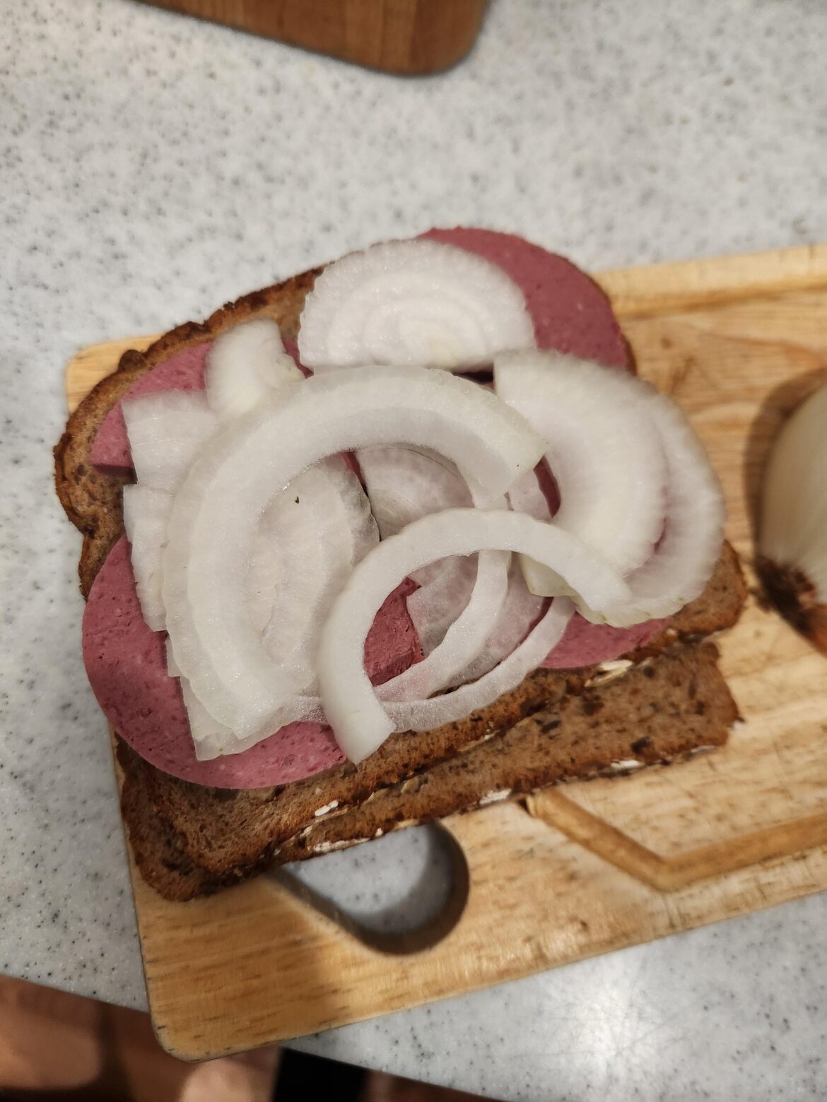 Liver and onions anyone?