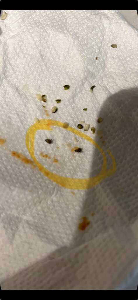 Weird spiky things in hemps hearts Weird spiky things in hemps hearts