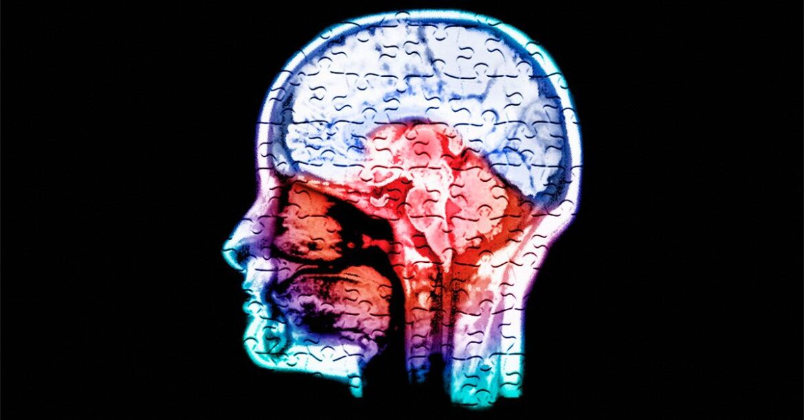 Do calcium and magnesium deficiencies affect brain health?