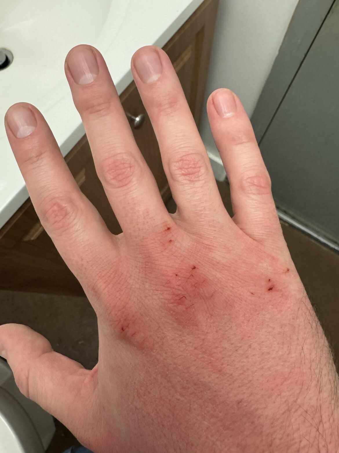 between the cold weather, and having to let a dishwasher go and subsequently closing dish a few nights after closing the line, my hands are fucked. i would appreciate any tips for relieving cracked hands