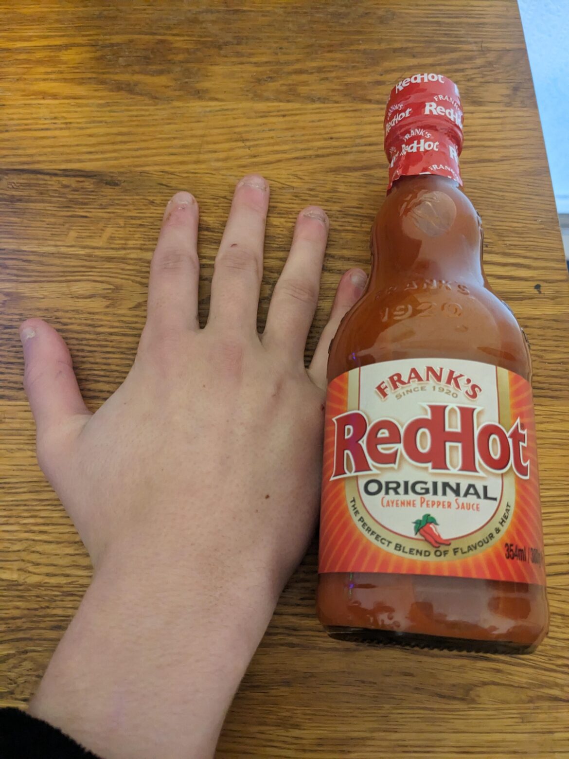Large Frank compared to my hand