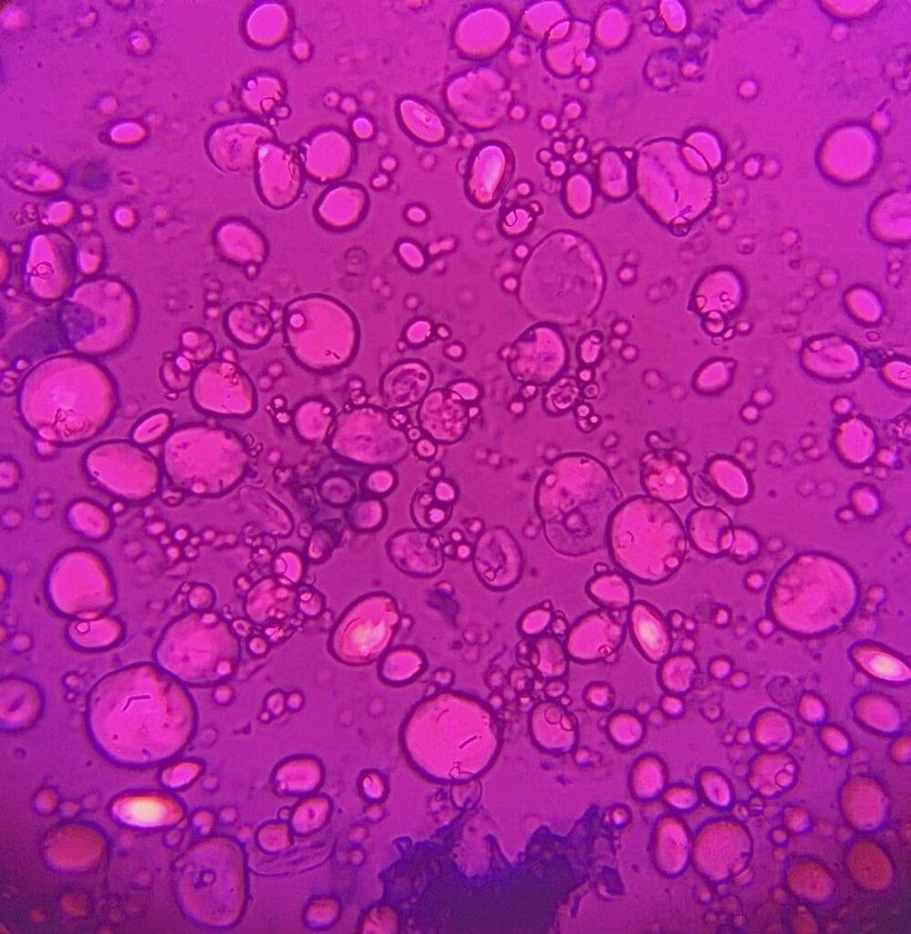 My stater under 40x magnification