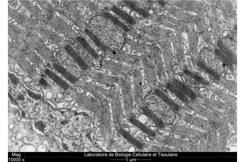 Longitudinal section illustrating the lattice-like configuration within the sonic muscle in Parophidion vassali. Credit: Marc Thiry/University of Liège Muscle fibres: an unexpected organisation revealed