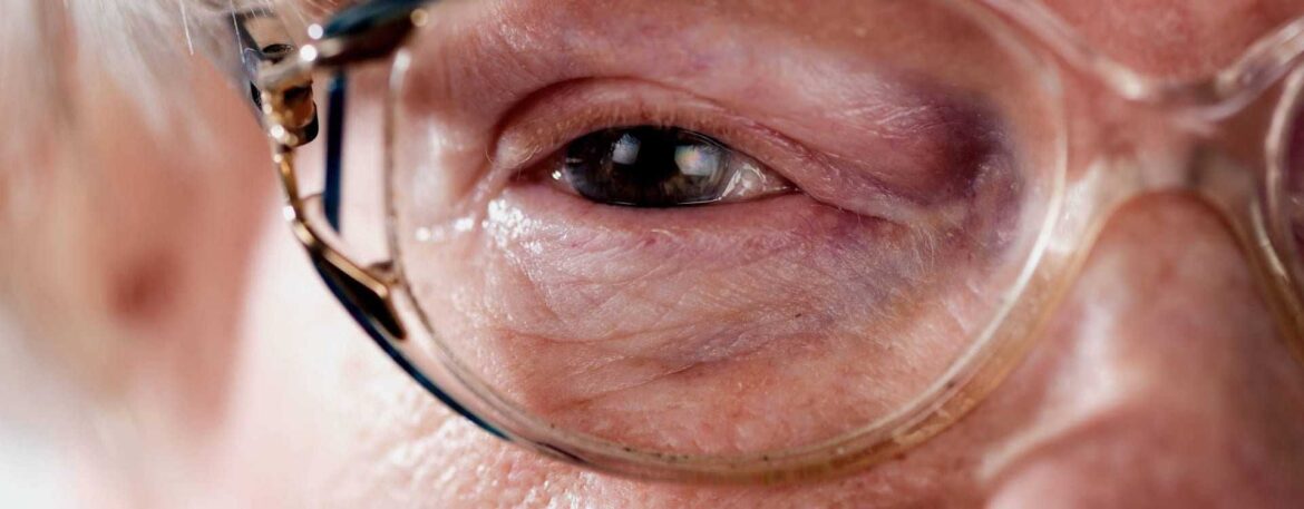 Olive Oil May Protect Against Age-Related Macular Degeneration Olive Oil May Protect Against Age-Related Macular Degeneration