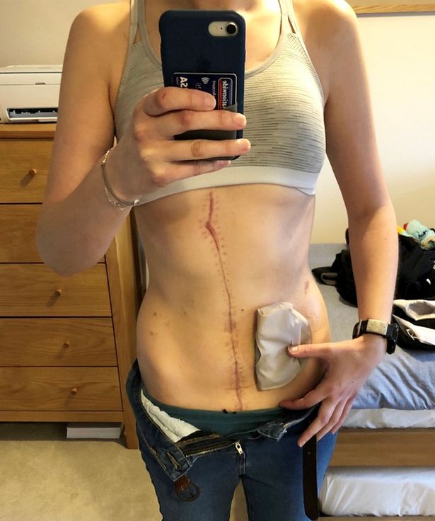 Rebecca's scars