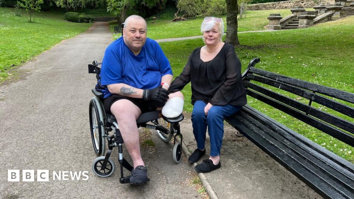 A man is sitting in a wheelchair in a park holding his wife's hand who is sitting on a bench next to him.  His left leg has been amputated below the knee.  He is wearing shorts and a blue polo shirt and his wife is wearing jeans and a black top.