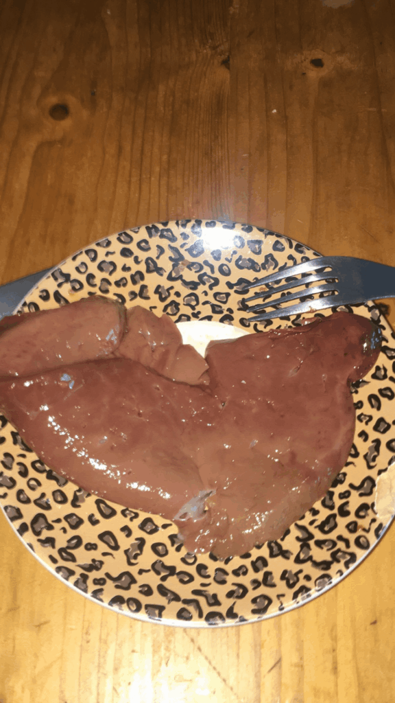 liver expert here pls ? i need help