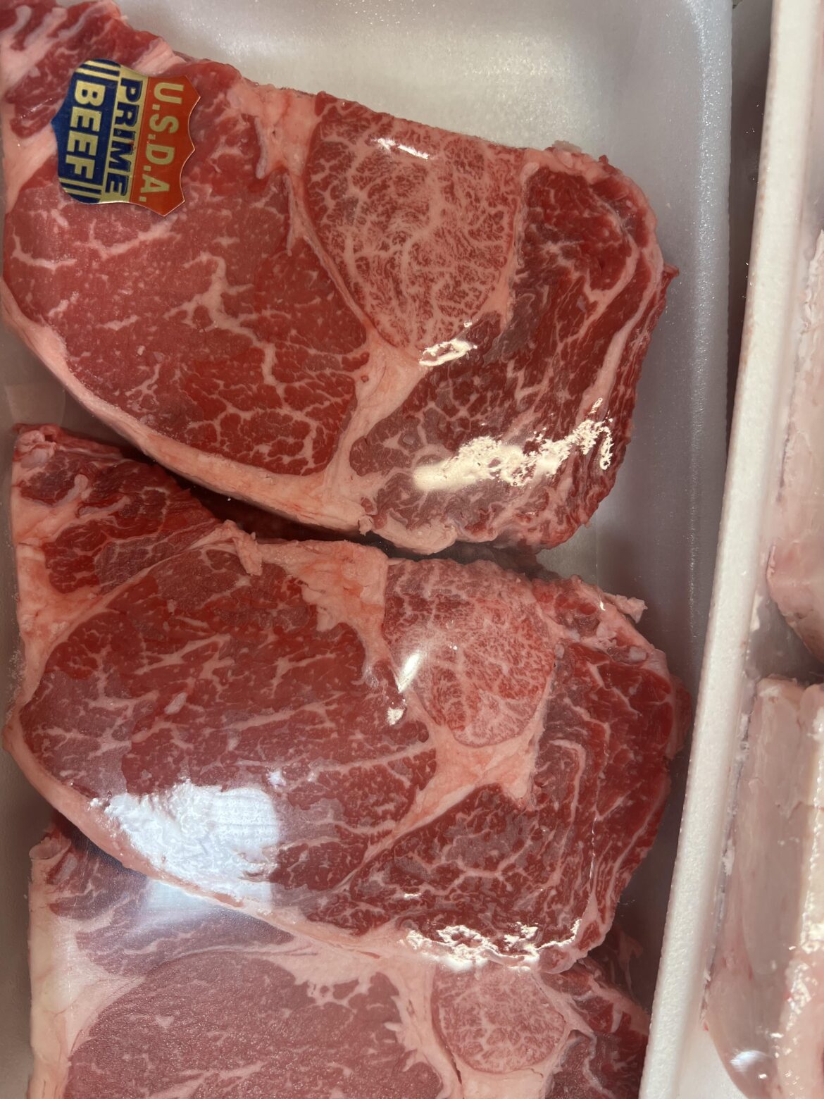 Is this small section steatosis?