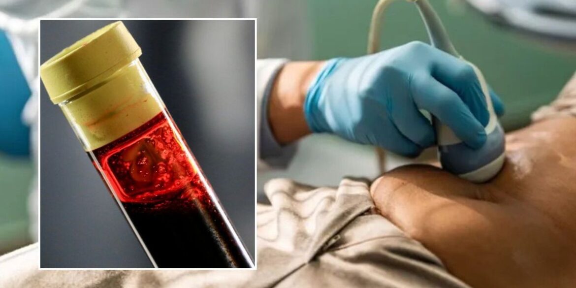 Supplement found to flush cancer-causing substance from body Supplement found to flush cancer-causing substance from body