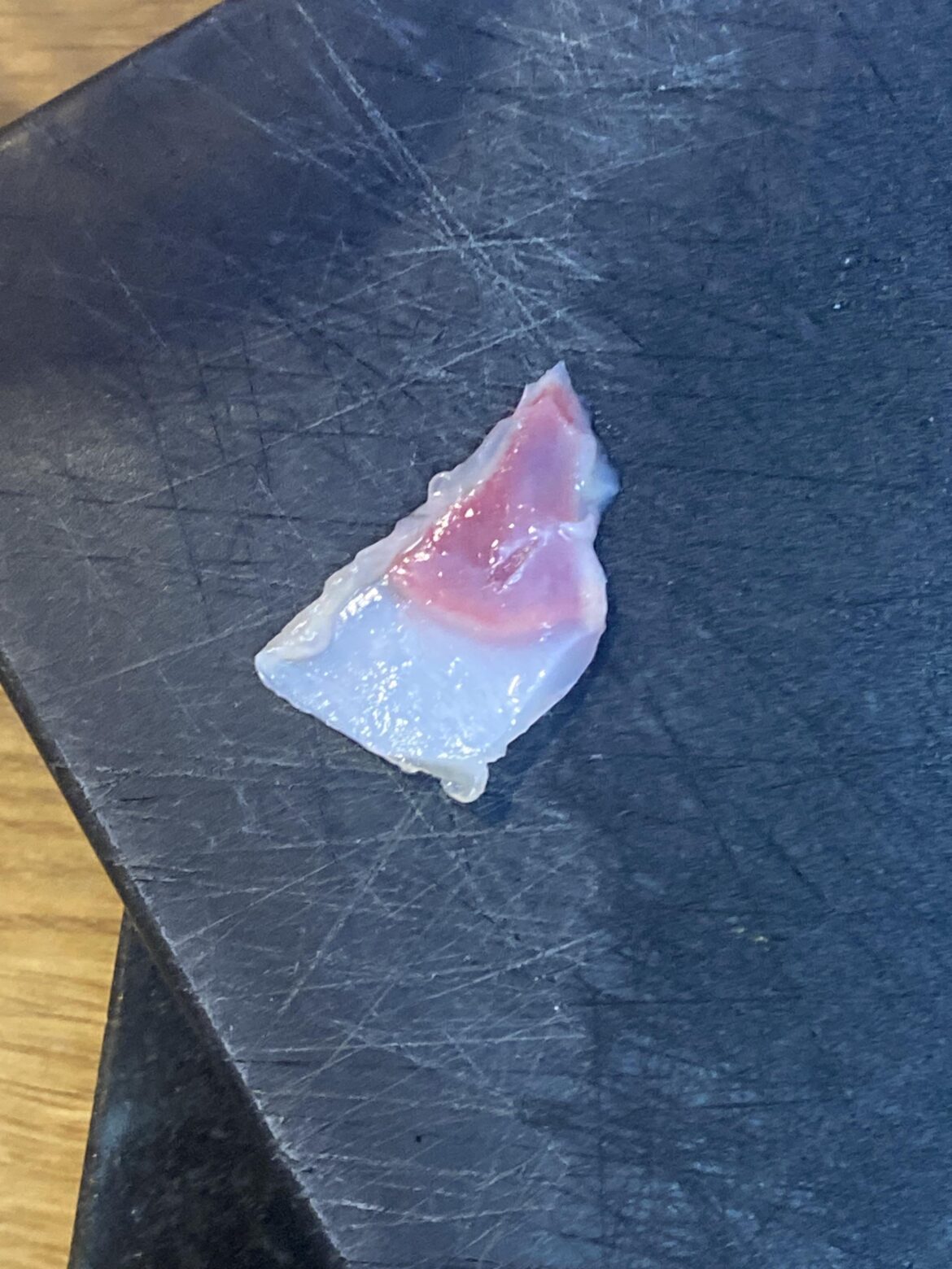 what is this in my chicken breast??? what is this in my chicken breast???