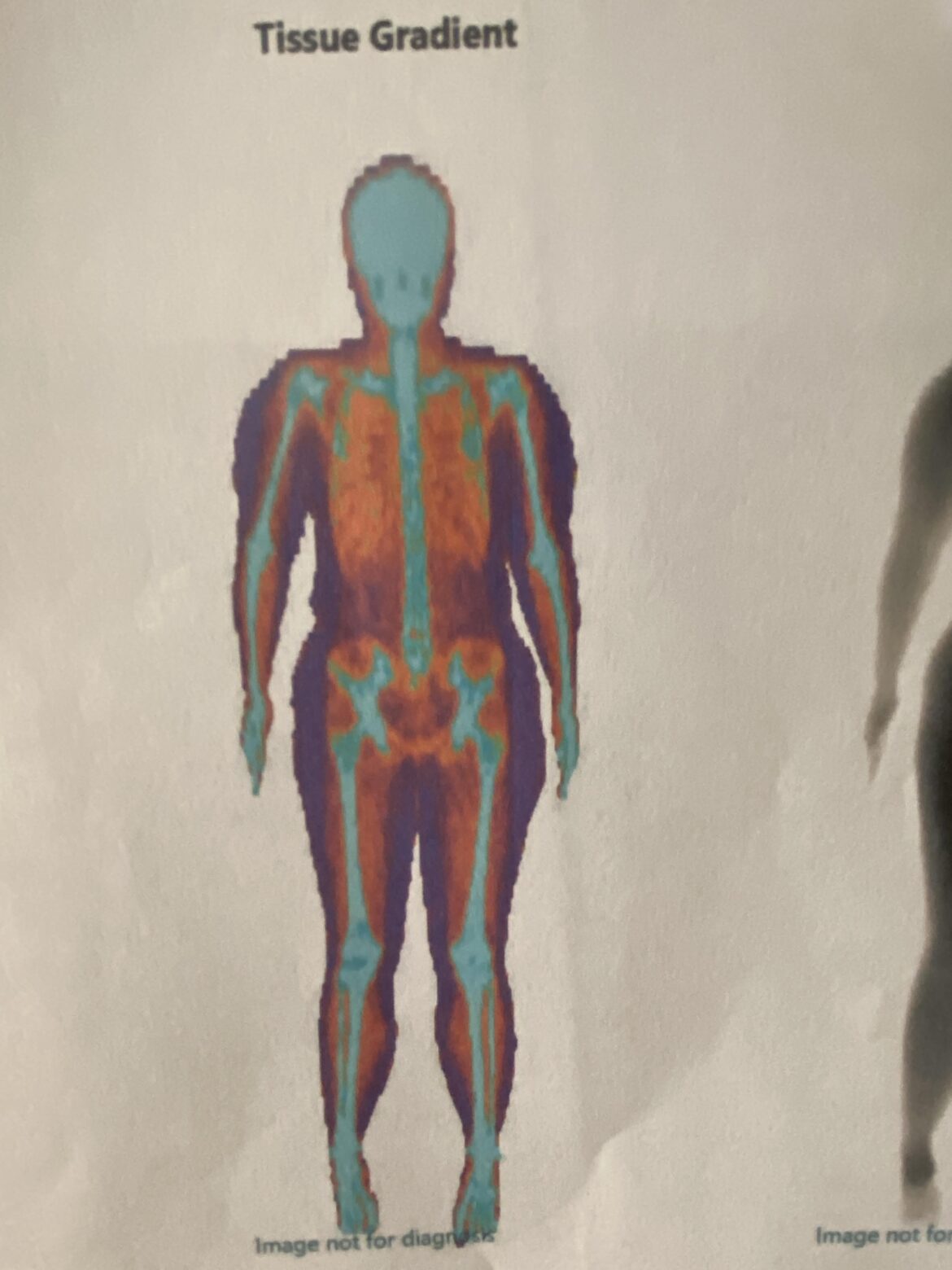 Just finished my first dexa scan, I guess I’m one of you guys now.