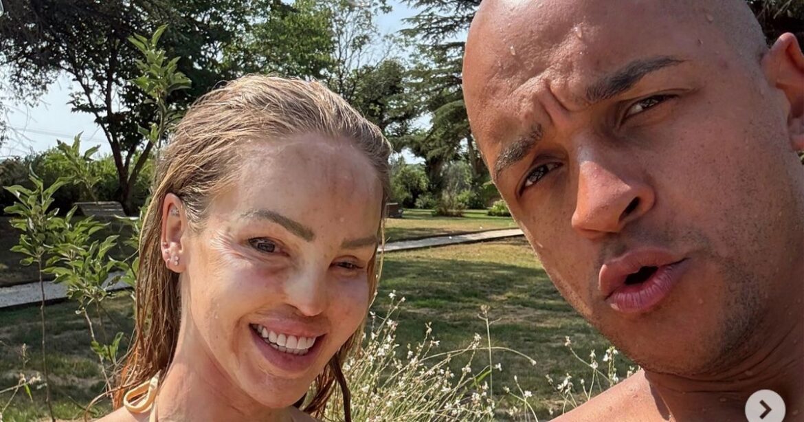 Katie Piper looks incredible in butter yellow bikini on ‘recharging’ holiday in France Ipso logo