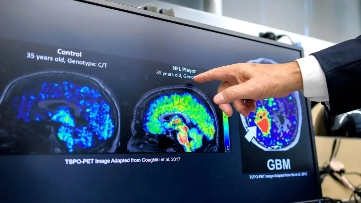 Today is World Alzheimer's Day. From diet to hobbies, the ten commandments of prevention.