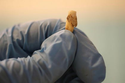 Profile of a mandible with calculus, from a Southern Italian Neolithic sample (~5.000 BCE)