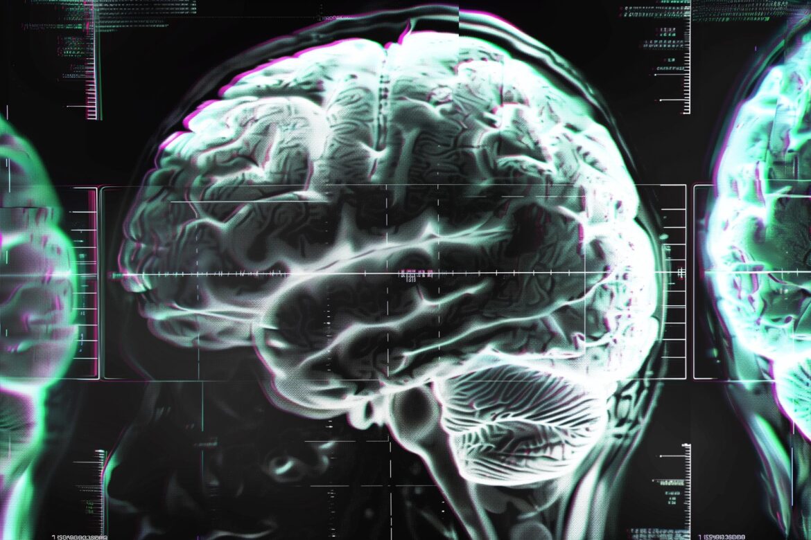 Brain Disorder Glitch Concept