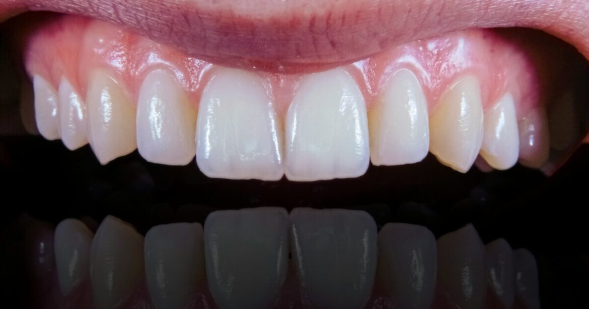 Mediterranean diet linked to healthier gums, study finds