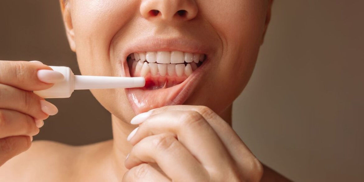 Diet that strengthens gums and stops inflammation – scientists are surprised by the results