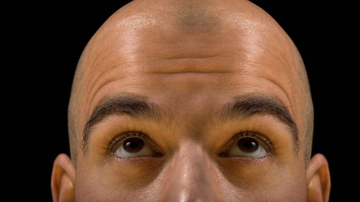 What you eat and drink can contribute to your hair loss What you eat and drink can contribute to your hair loss