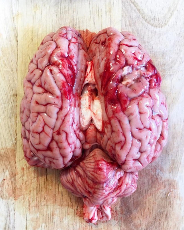 BUDAPEST, HUNGARY: Natalie enjoys eating brains. THIS WOMAN claims a vegan diet left her barely able to hold a GLASS OF WATER - but since swapping plants for ANIMAL BRAINS she?s never felt better. Nutrition consultant, Natalie Daniels (38) who lives in Budapest, Hungary, grew up following a modern Mediterranean diet which consisted of pasta, bread, rice, potatoes, vegetables, lean meat and olive oil. In her late teens and early twenties, Natalie started to notice a connection between the foods she ate and the way they made her feel. At the time she was also practising yoga and linked it with a plant-based diet for good health. She went pescatarian and over time she lost her period and her health started to decline. In 2009 Natalie decided to strip out fish, eggs and dairy from her diet and go vegan. She cooked her meals from scratch and took vitamins and other health supplements but instead of feeling better in herself, her appearance started to change, she lost muscle tone, became pale and had sunken eyes with dark circles. As well as this, Natalie was diagnosed with a thyroid condition, had constipation, was bloated, suffered from hair loss, scalp eczema, sensitive teeth, brain fog and developed joint pain so severe she struggled to hold a glass of water in her hands. Natalie followed a largely vegetarian diet for 12 years and was vegan for three, but in 2015 she decided to re-introduce animal products into her diet until in January 2018, she discovered the carnivore diet and adopted the Paleolithic ketogenic diet (PKD), a type of meat-only diet where she eats solely animal products at a 2:1 fat to protein ratio. She enjoys a wide range of animal products from liver, brain, ribeye steak, beef tartare, raw lamb, pork crackling, pork ribs and broths made from boiling animal offcuts including the head. In a year Natalie has gone from 5st 11lb to 6st 10lb and says all her previous health symptoms have been alleviated and says that without this diet she would not be