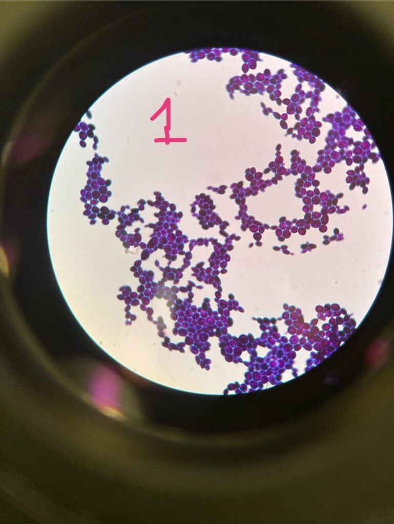 I cultured my starter… [UPDATE] gram stain photos