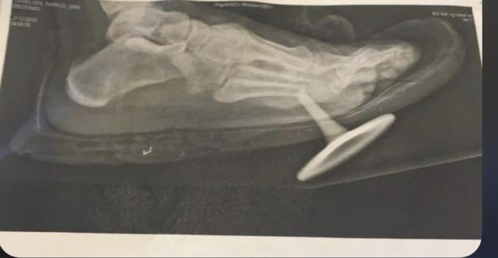 Remember your safety shoes kids