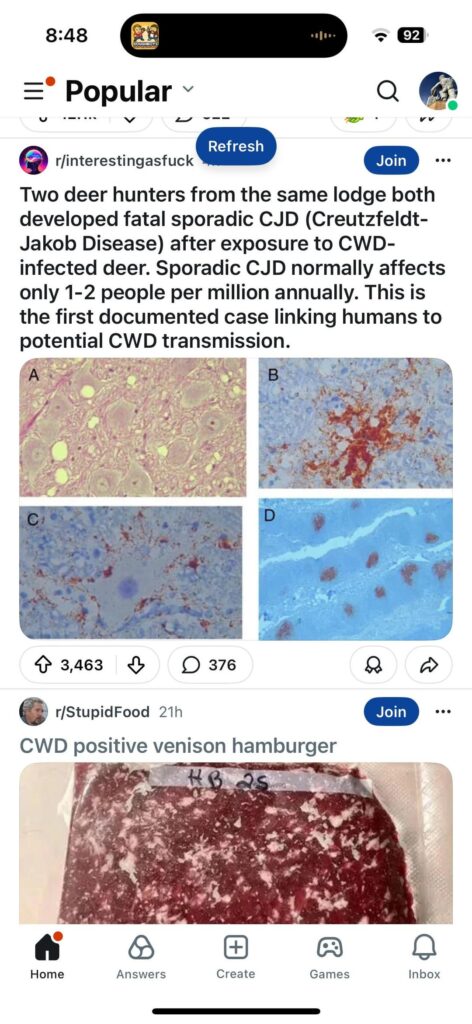 Stupid Food Got Stupider! Alt title: CWD Deer Meat Is a No-Brainer!