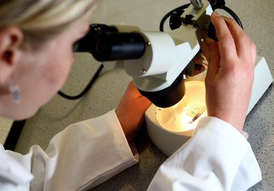 Study of fossil human teeth reveals diversity of Italian Iron Age diet Study of fossil human teeth reveals diversity of Italian Iron Age diet