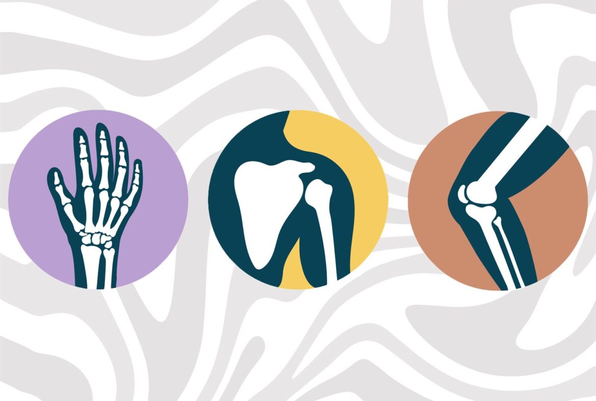 What Happens to Your Bones When You Take Calcium