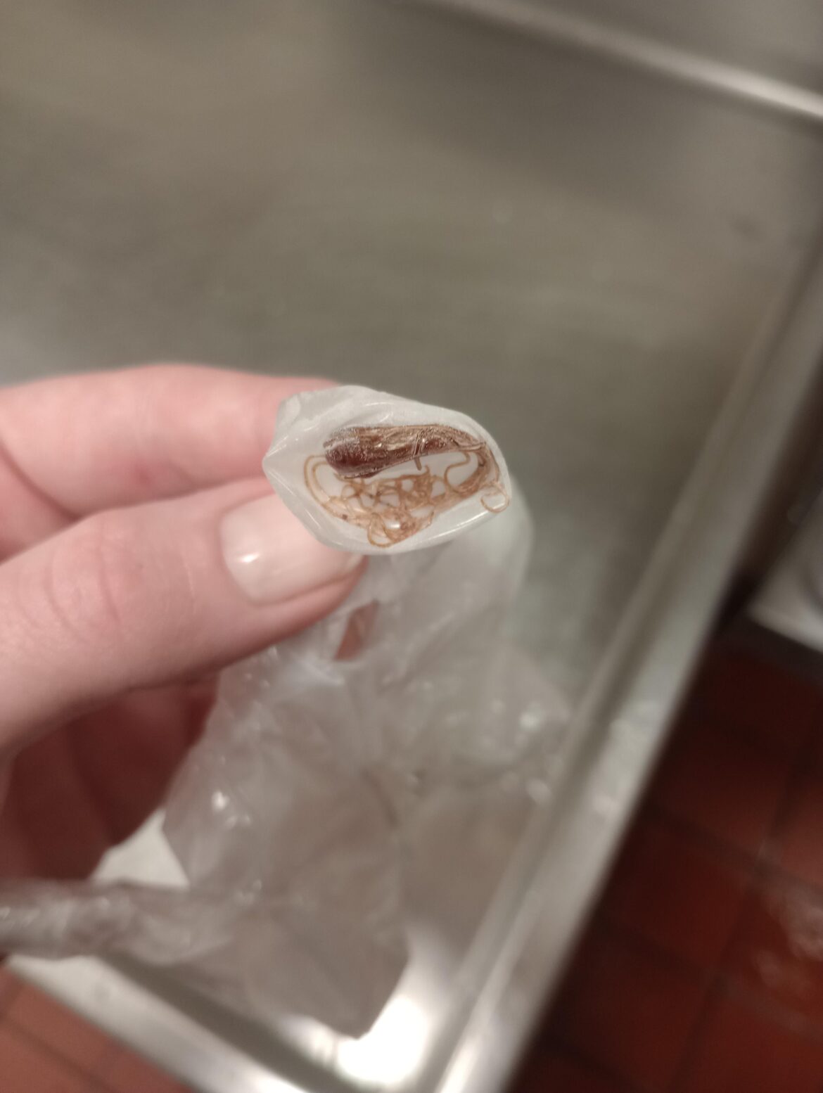 Glove from a brand new box gave me a jump scare. This was on the inside. Please tell me it's just melted plastic/vinyl