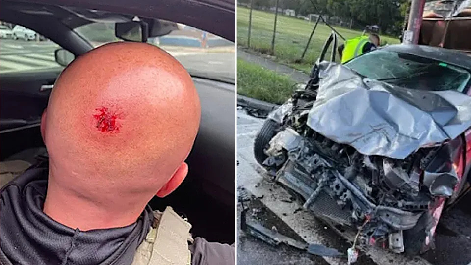 split photo of head wound and car crash