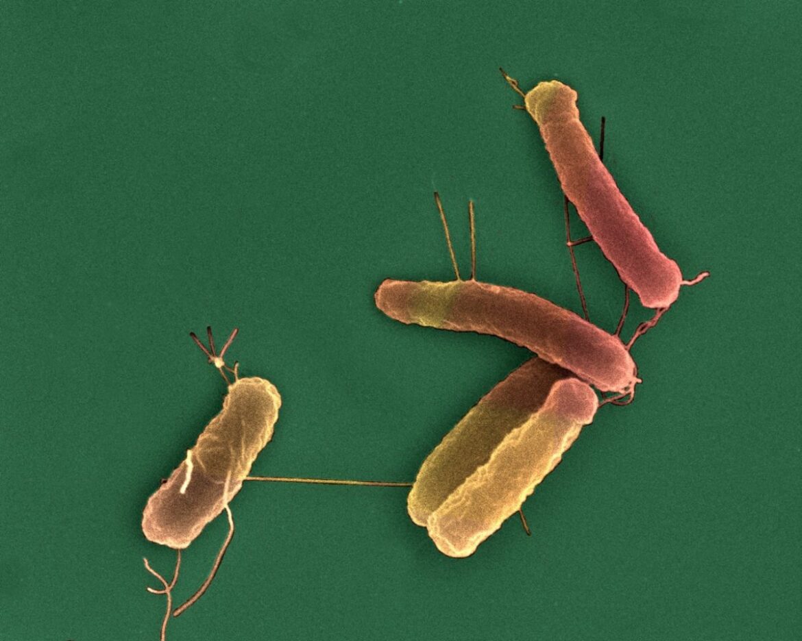 update on the epidemiological situation |