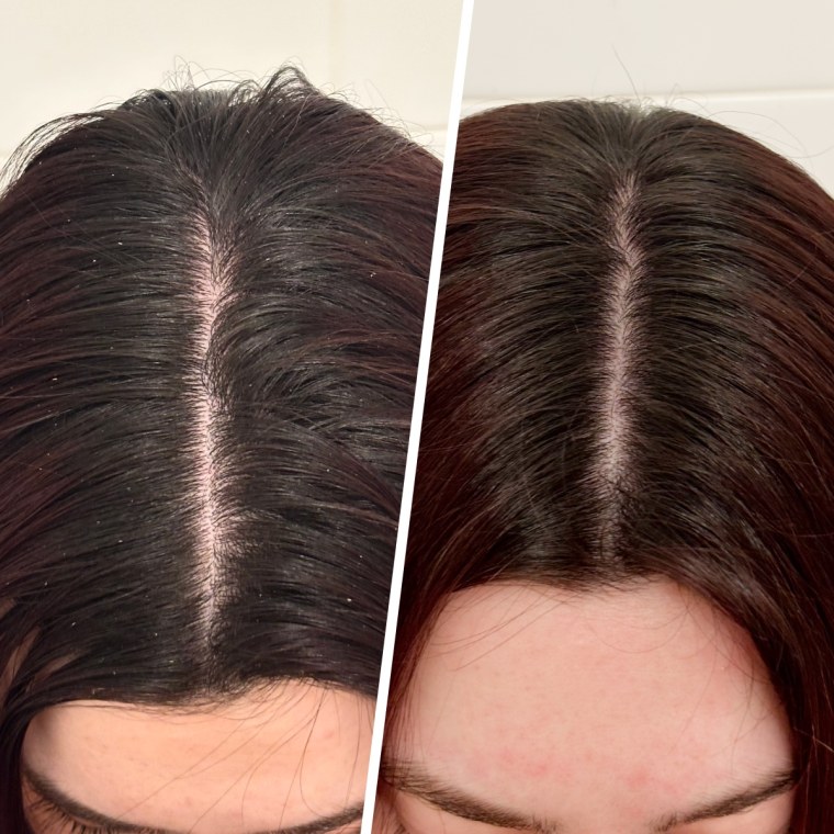 Before (left) and after (right)