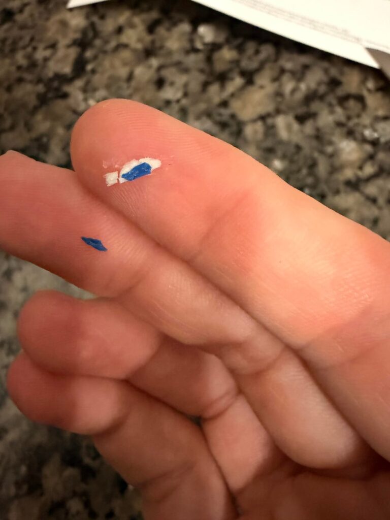 What is in my noodle